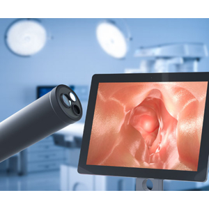Les caméras IDS facilitent l'inspection visuelle automatique des endoscopes rigides.